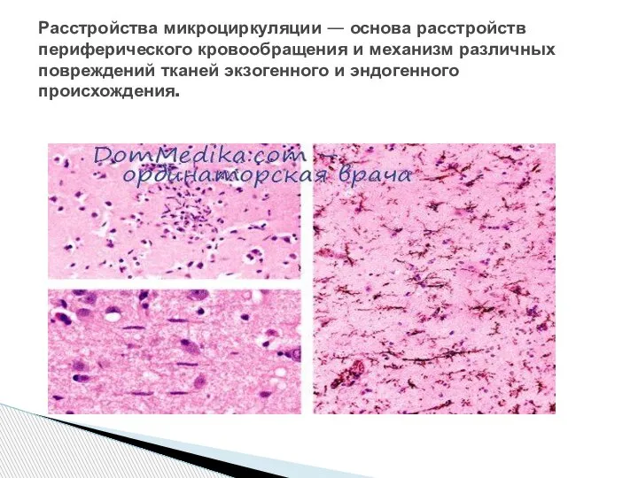 Расстройства микроциркуляции — основа расстройств периферического кровообращения и механизм различных повреждений тканей экзогенного и эндогенного происхождения.