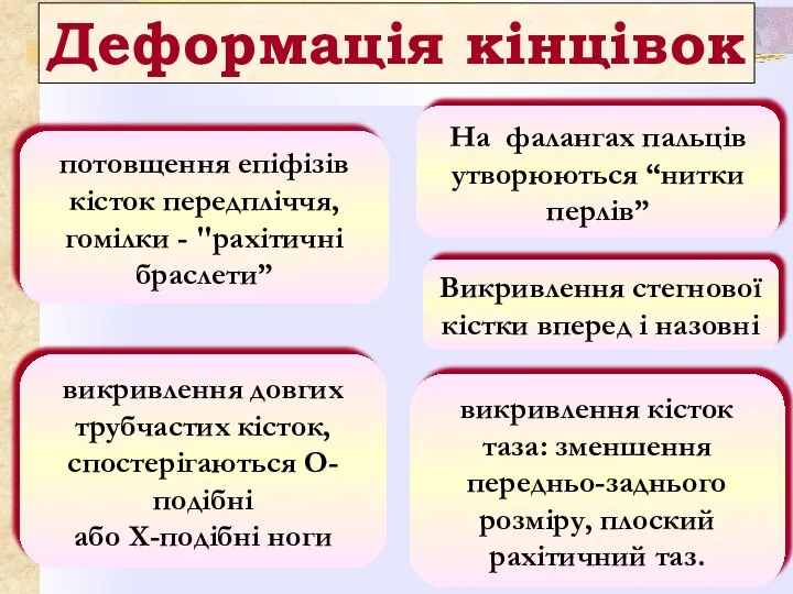 Деформація кінцівок потовщення епіфізів кісток передпліччя, гомілки - "рахітичні браслети” На фалангах