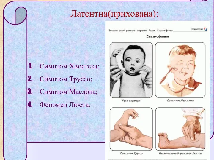 Латентна(прихована): Симптом Хвостека; Симптом Труссо; Симптом Маслова; Феномен Люста.