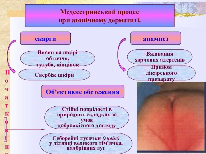 Медсестринський процес при атопічному дерматиті. скарги анамнез Висип на шкірі обличчя, тулуба,