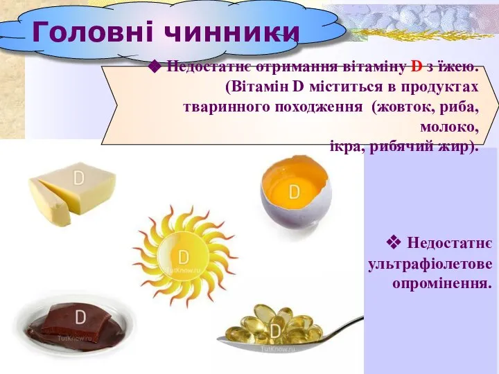 Недостатнє ультрафіолетове опромінення. Головні чинники Недостатнє отримання вітаміну D з їжею. (Вітамін