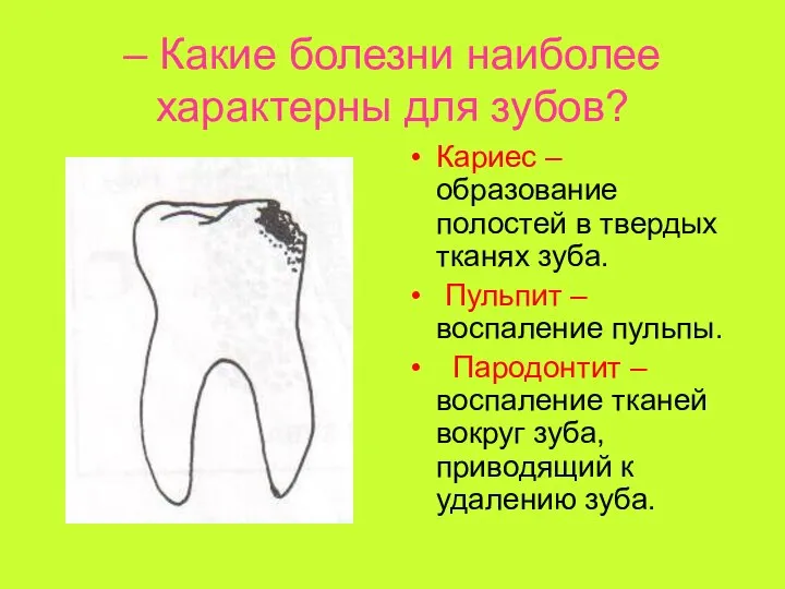 – Какие болезни наиболее характерны для зубов? Кариес – образование полостей в