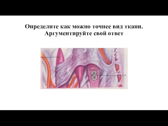 Определите как можно точнее вид ткани. Аргументируйте свой ответ