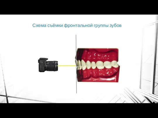 Схема съёмки фронтальной группы зубов