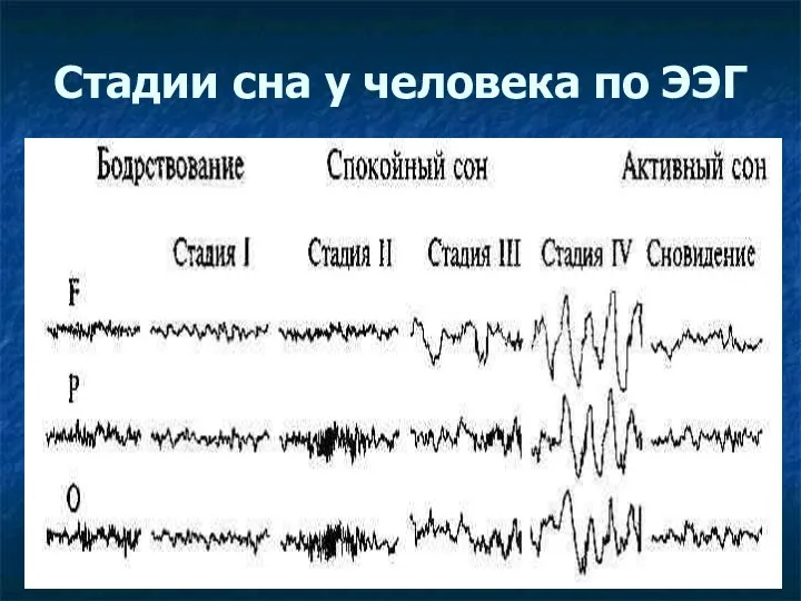 Стадии сна у человека по ЭЭГ