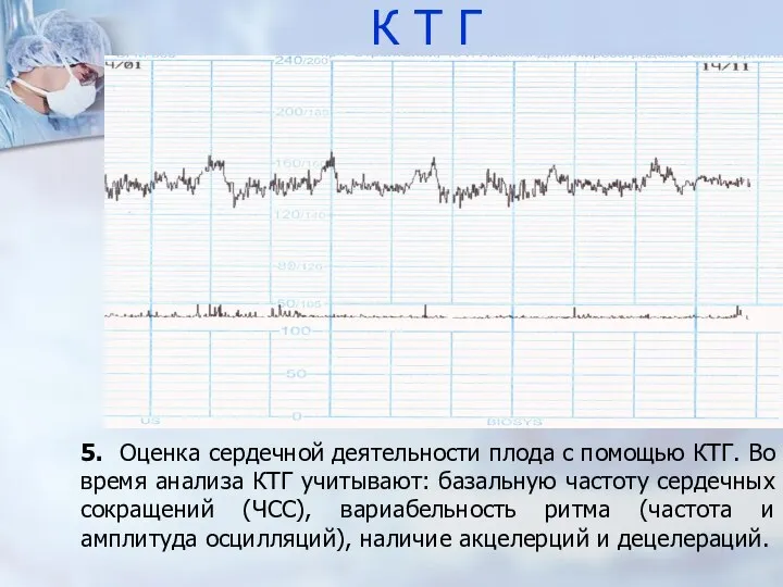 К Т Г 5. Оценка сердечной деятельности плода с помощью КТГ. Во