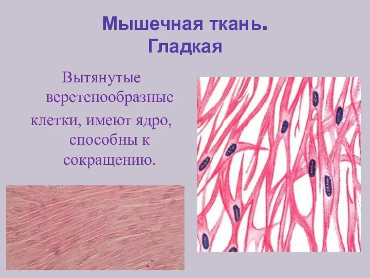 Мышечная ткань. Гладкая Вытянутые веретенообразные клетки, имеют ядро, способны к сокращению.