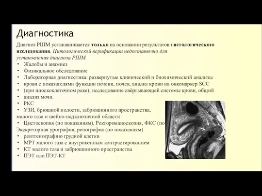 Диагностика Диагноз РШМ устанавливается только на основании результатов гистологического исследования. Цитологической верификации