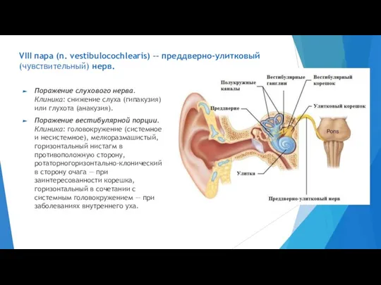 VIII пара (n. vestibulocochlearis) –– преддверно-улитковый (чувствительный) нерв. Поражение слухового нерва. Клиника: