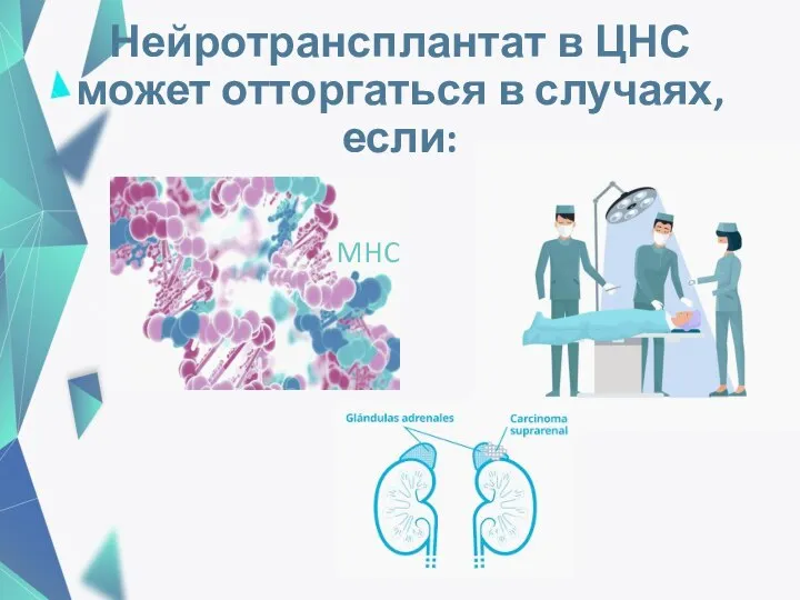 Нейротрансплантат в ЦНС может отторгаться в случаях, если: MHC