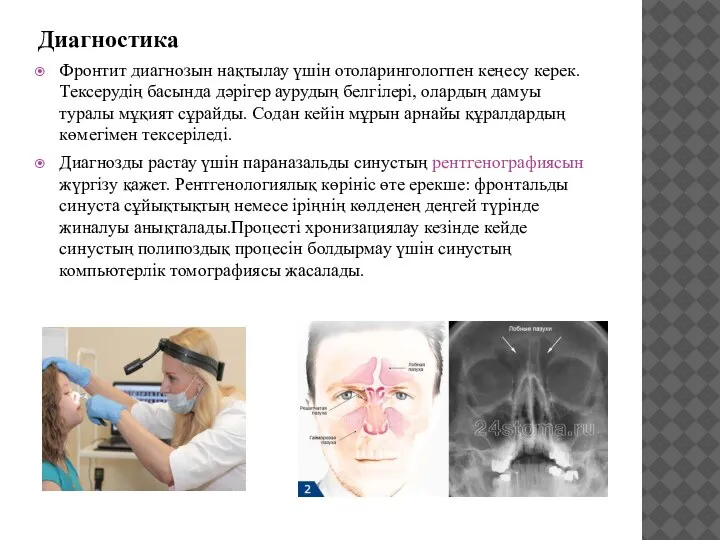 Диагностика Фронтит диагнозын нақтылау үшін отоларингологпен кеңесу керек. Тексерудің басында дәрігер аурудың