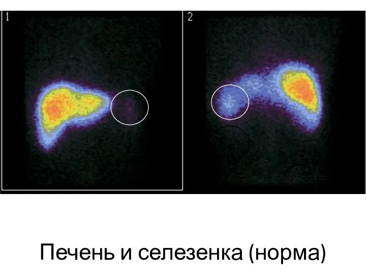 Печень и селезенка (норма)