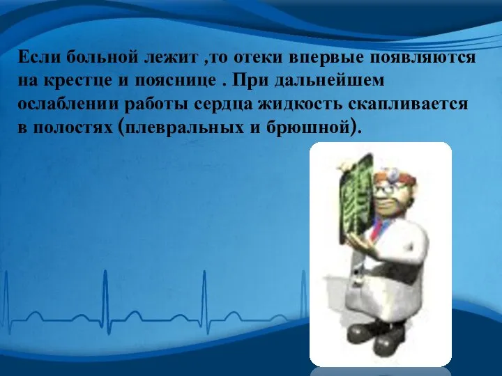 Если больной лежит ,то отеки впервые появляются на крестце и пояснице .