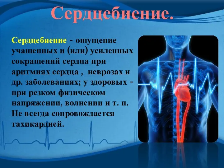 Сердцебиение. Сердцебиение - ощущение учащенных и (или) усиленных сокращений сердца при аритмиях