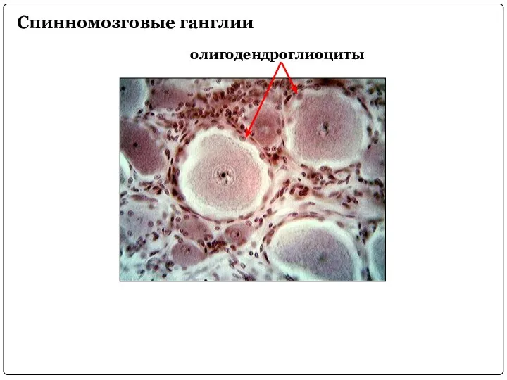 Спинномозговые ганглии олигодендроглиоциты