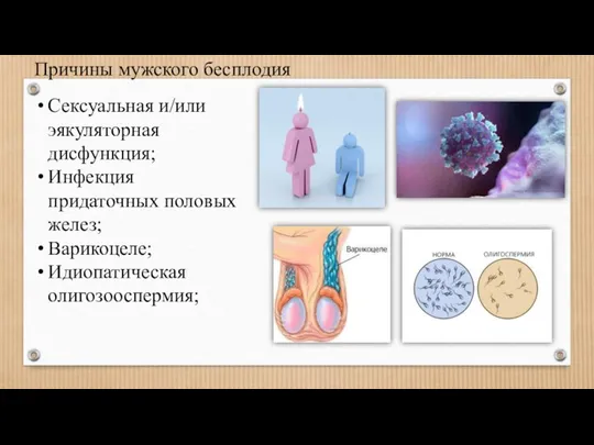 Сексуальная и/или эякуляторная дисфункция; Инфекция придаточных половых желез; Варикоцеле; Идиопатическая олигозооспермия; Причины мужского бесплодия