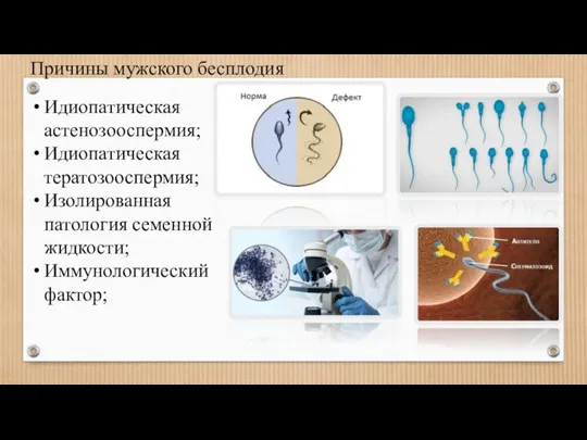 Идиопатическая астенозооспермия; Идиопатическая тератозооспермия; Изолированная патология семенной жидкости; Иммунологический фактор; Причины мужского бесплодия