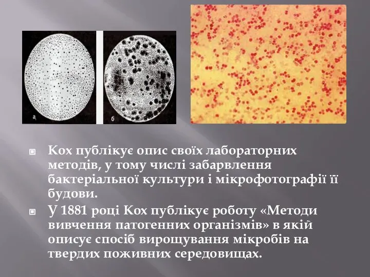 Кох публікує опис своїх лабораторних методів, у тому числі забарвлення бактеріальної культури