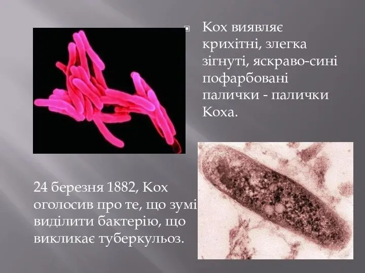 Кох виявляє крихітні, злегка зігнуті, яскраво-сині пофарбовані палички - палички Коха. 24