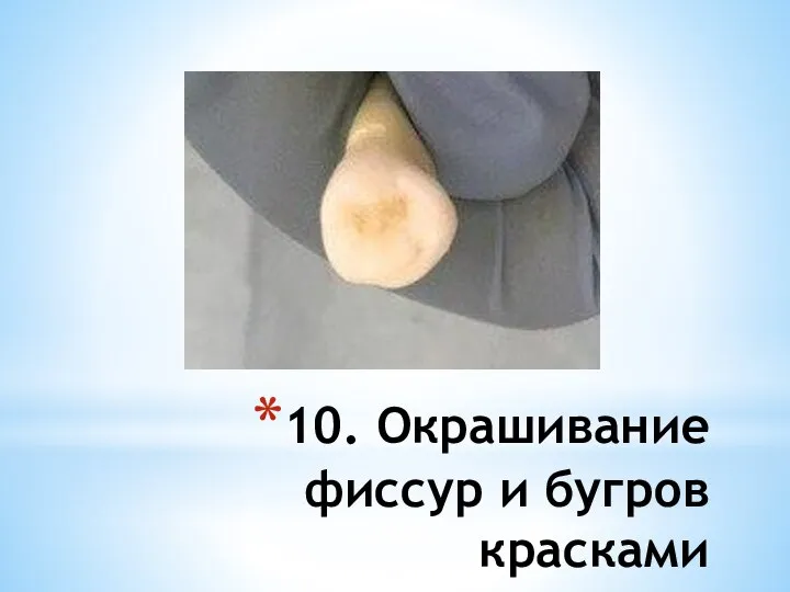 10. Окрашивание фиссур и бугров красками