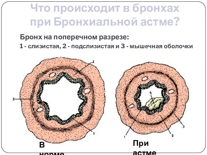 Бронх на поперечном разрезе: 1 - слизистая, 2 - подслизистая и 3