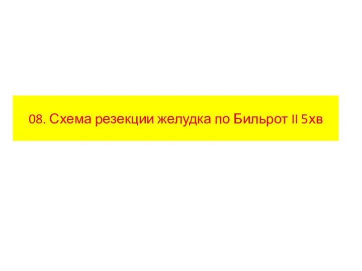 08. Схема резекции желудка по Бильрот II 5хв