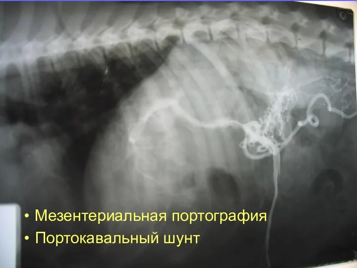 Мезентериальная портография Портокавальный шунт