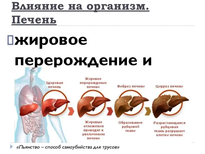 жировое перерождение и цирроз Влияние на организм. Печень «Пьянство – способ самоубийства для трусов»