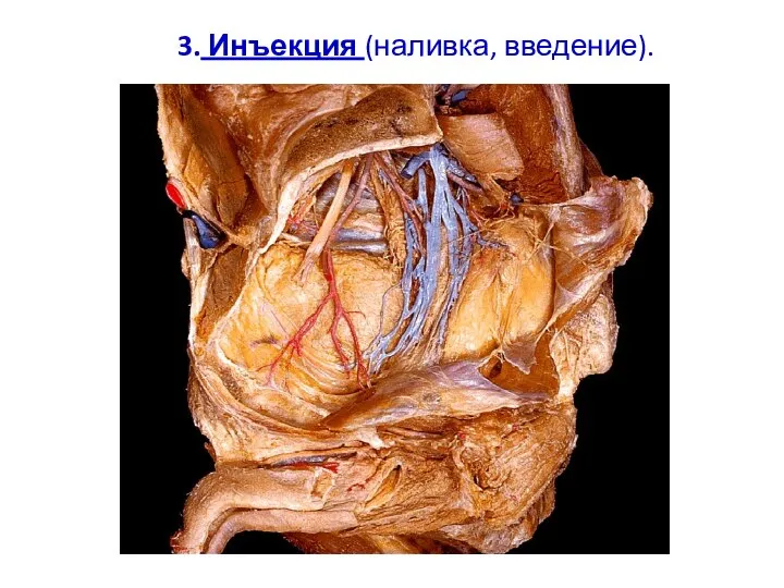 3. Инъекция (наливка, введение).