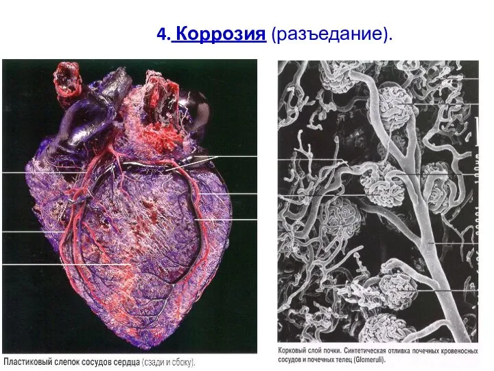 4. Коррозия (разъедание).