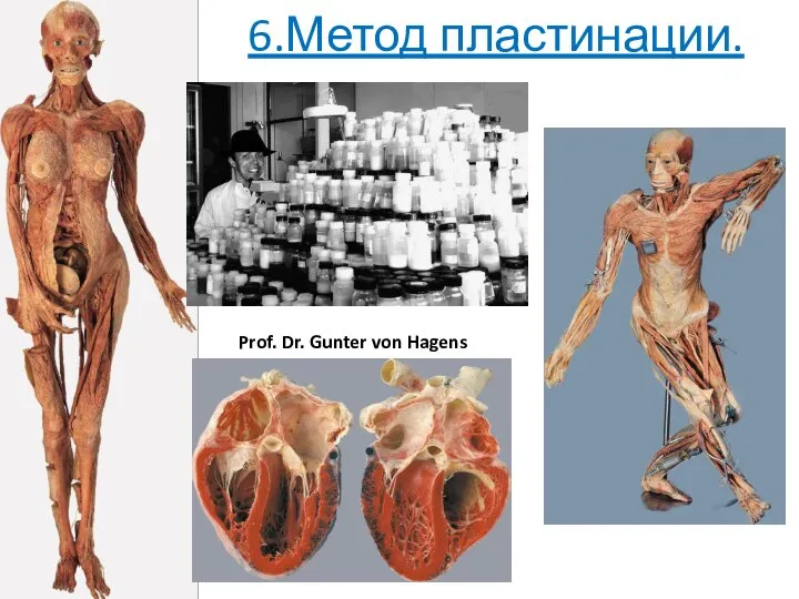 6.Метод пластинации. Prof. Dr. Gunter von Hagens