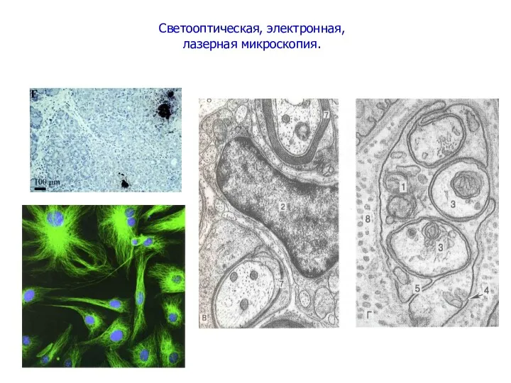 Светооптическая, электронная, лазерная микроскопия.