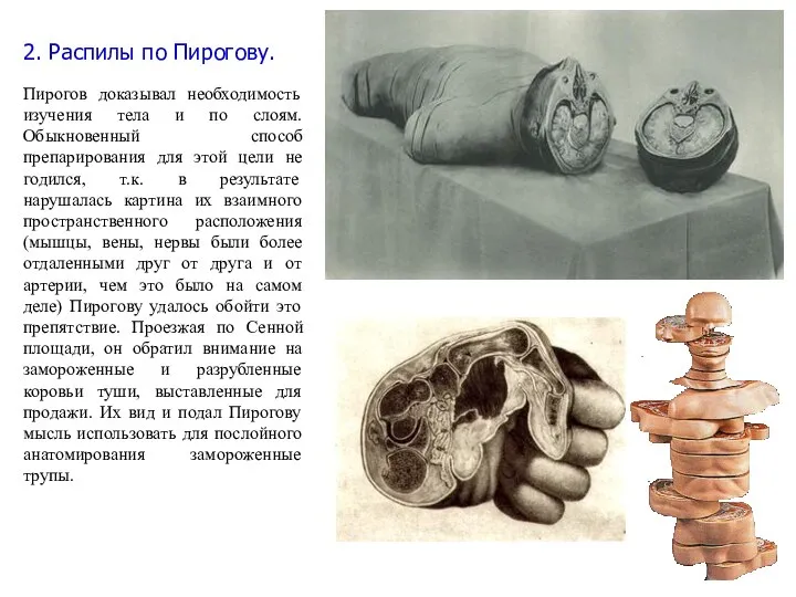 2. Распилы по Пирогову. Пирогов доказывал необходимость изучения тела и по слоям.