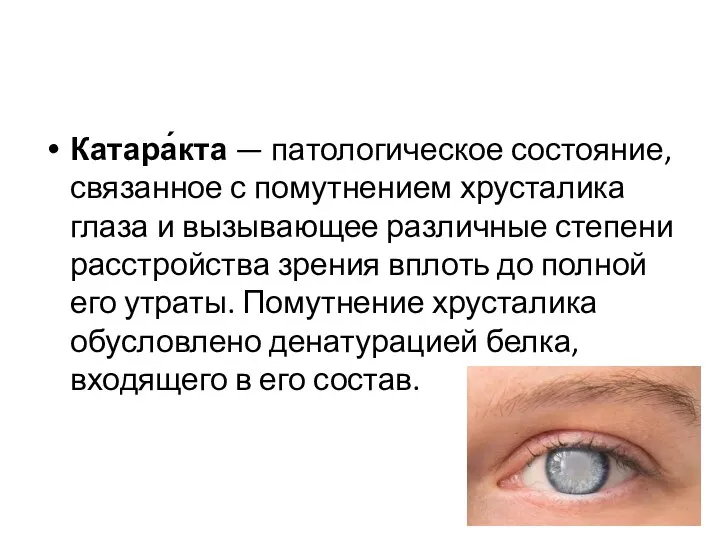 Катара́кта — патологическое состояние, связанное с помутнением хрусталика глаза и вызывающее различные