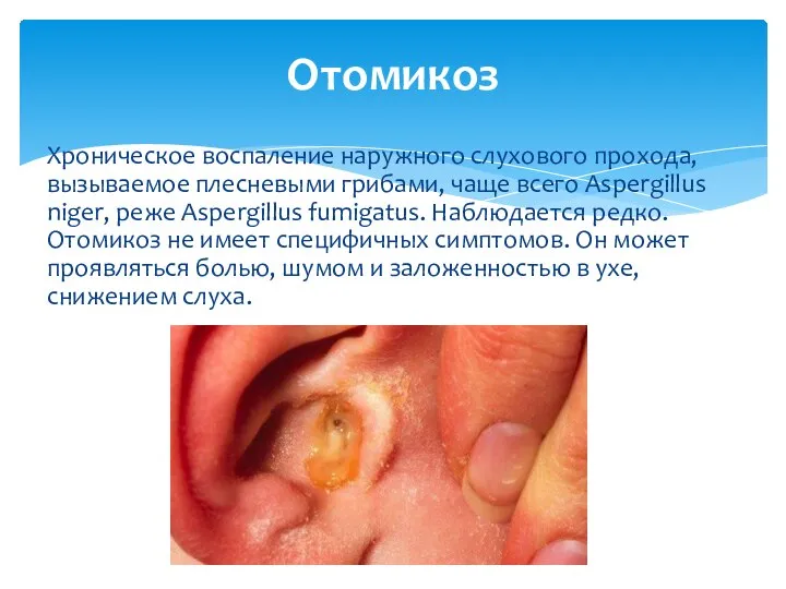 Хроническое воспаление наружного слухового прохода, вызываемое плесневыми грибами, чаще всего Aspergillus niger,
