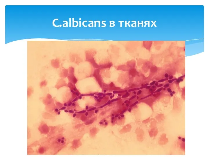 C.albicans в тканях