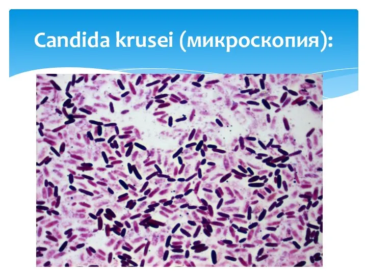 Candida krusei (микроскопия):
