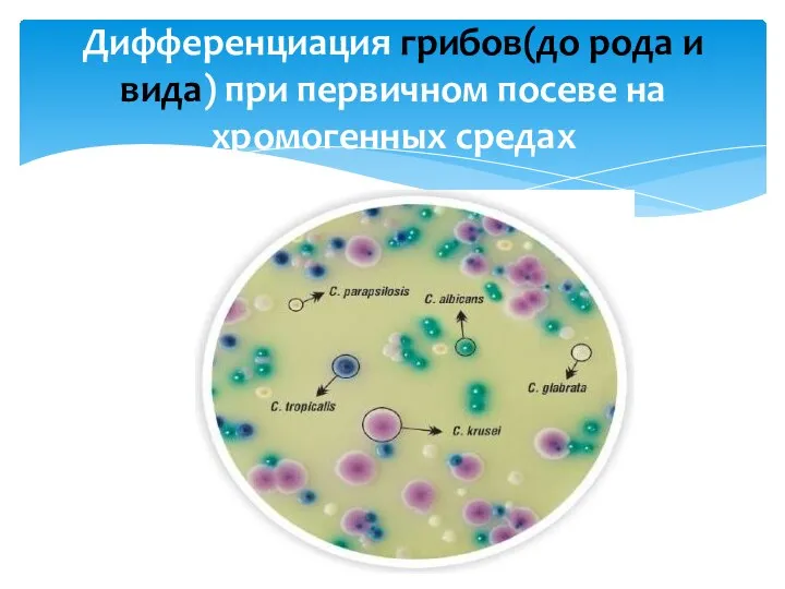 Дифференциация грибов(до рода и вида) при первичном посеве на хромогенных средах