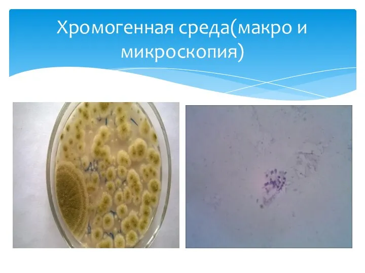 Хромогенная среда(макро и микроскопия)