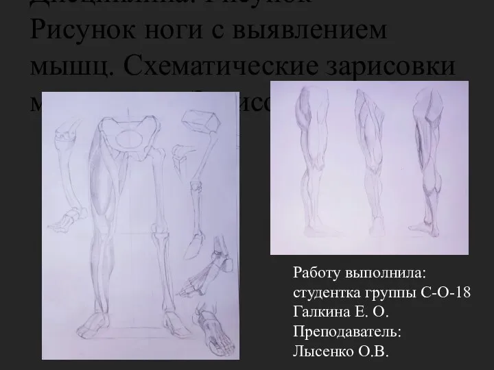 Дисциплина: Рисунок Рисунок ноги с выявлением мышц. Схематические зарисовки мышц ноги. Зарисовки