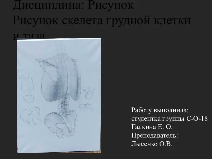 Дисциплина: Рисунок Рисунок скелета грудной клетки и таза. Работу выполнила: студентка группы