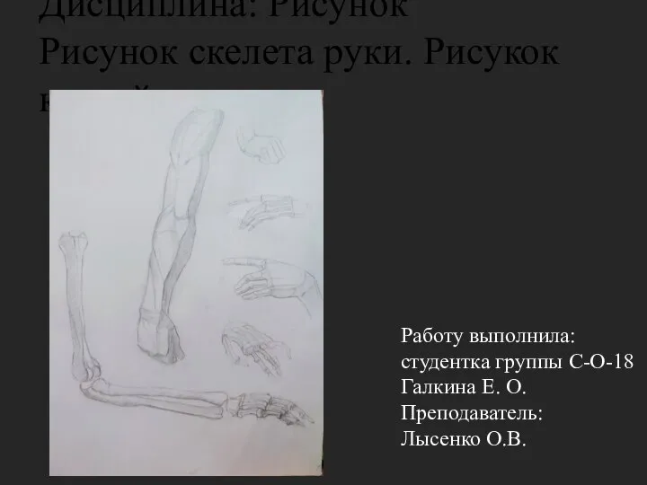 Дисциплина: Рисунок Рисунок скелета руки. Рисукок кистей рук. Работу выполнила: студентка группы