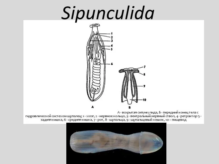 Sipunculida