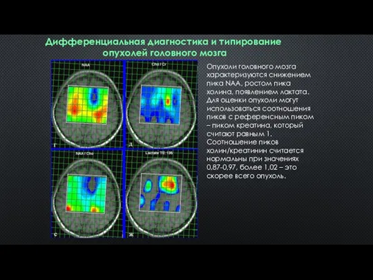 Дифференциальная диагностика и типирование опухолей головного мозга Опухоли головного мозга характеризуются снижением