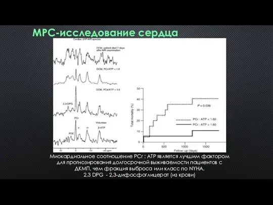 МРС-исследование сердца Миокардиальное соотношение PCr : ATP является лучшим фактором для прогнозирования