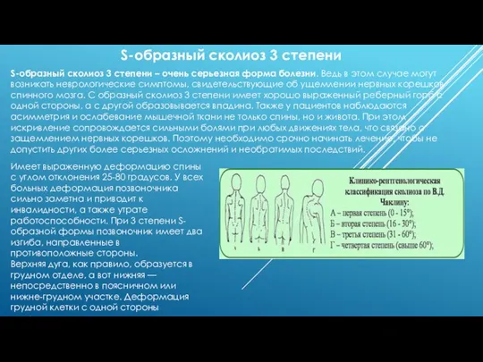 S-образный сколиоз 3 степени S-образный сколиоз 3 степени – очень серьезная форма