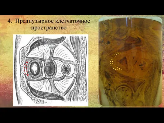 4. Предпузырное клетчаточное пространство