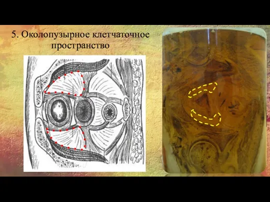 5. Околопузырное клетчаточное пространство