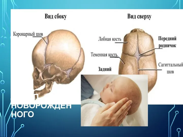 ЧЕРЕП НОВОРОЖДЕННОГО