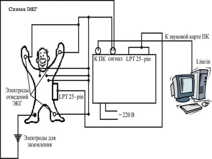 Схема ЭКГ